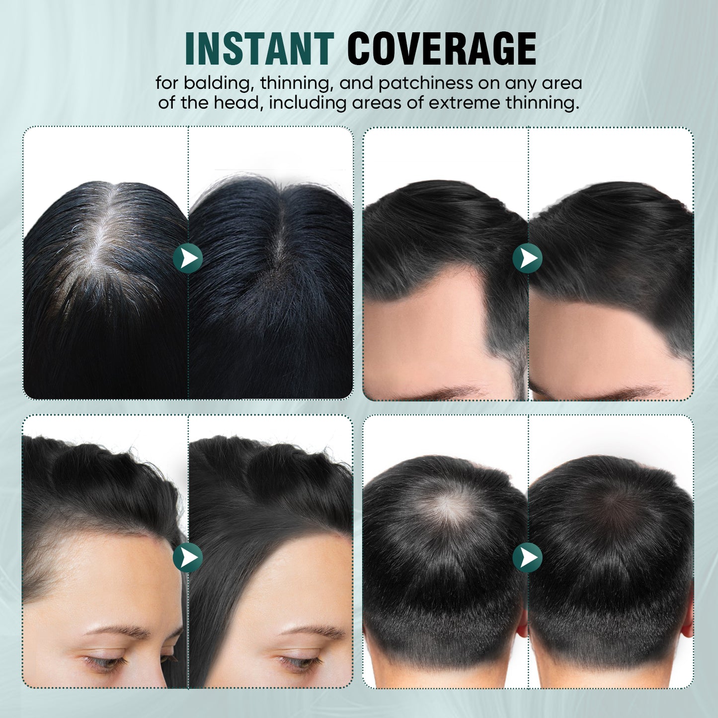 FARNDU Hairline Powder 12g | Coverage Roots and Hair Loss | Color Touch-Ups | Dual - Brush Design & Extra Replacement Packs